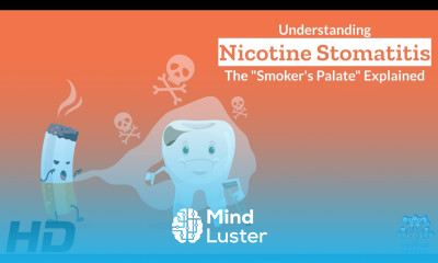 Unveiling Nicotine Stomatitis Inside the Smoker s Palate