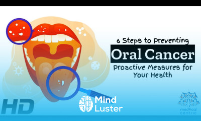 Oral Health Matters A 6 Step Guide to Preventing Oral Cancer