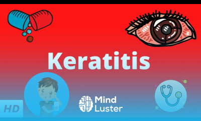 Keratitis Causes Signs and Symptoms Diagnosis and Treatment
