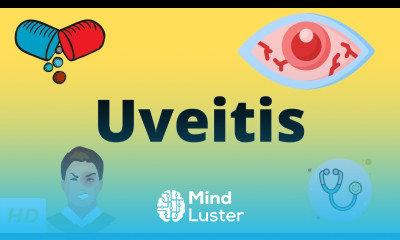 Uveitis Causes Signs and Symptoms Diagnosis and Treatment