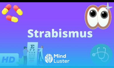 Strabismus Everything You Need To Know