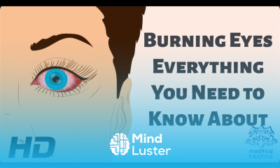 Burning Eyes Everything You Need to Know