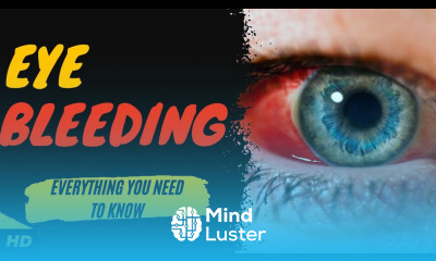 Eye Bleeding Everything You Need To Know