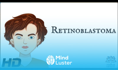 Retinoblastoma Everything You Need To Know