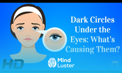 Unmasking the Causes What s Really Behind Those Pesky Dark Circles
