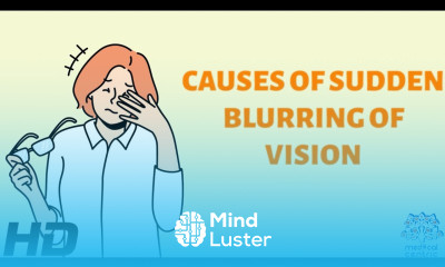 Unveiling the Mystery The Science Behind Sudden Blurring of Vision