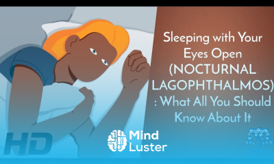 A Blinkless Slumber Unraveling the Phenomenon of Sleeping with Eyes Open