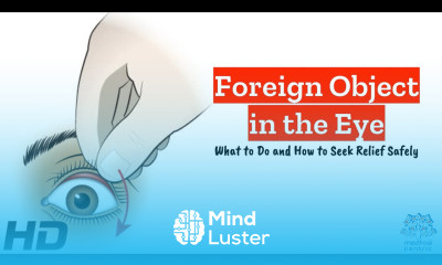 Foreign Object in the Eye Step by Step Emergency Guide