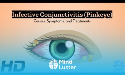 Infective Conjunctivitis Behind the Redness