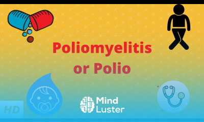 Poliomyelitis or polio Causes Signs and Symptoms Diagnosis and Treatment