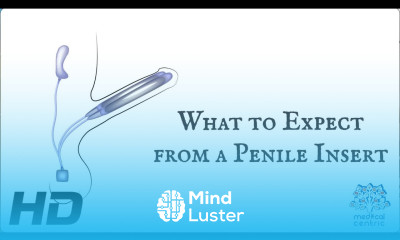 What To Expect From A Penile Insert