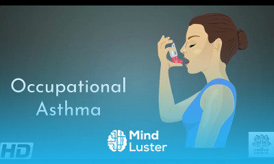 Occupational Asthma Causes Signs and Symptoms Diagnosis and Treatment