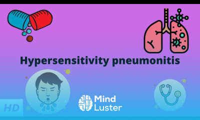 Hypersensitivity pneumonitis Causes Signs and Symptoms Diagnosis and Treatment