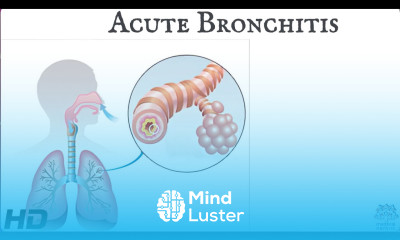 Acute bronchitis Everything You Need To Know
