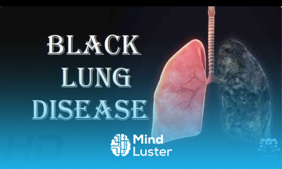 0 Everything You Need To Know