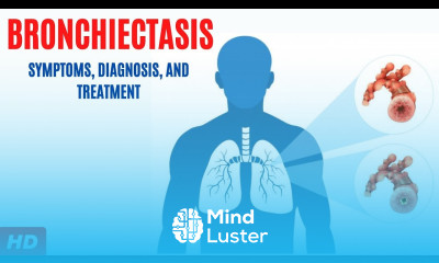 Bronchiectasis Symptoms Diagnosis and Treatment