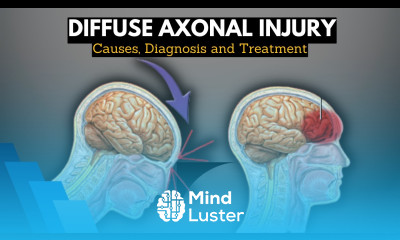 Diffuse Axonal Injury Causes Signs and Symptoms Diagnosis and Treatment