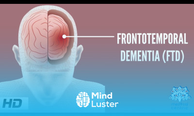 Frontotemporal Dementia Causes Signs and Symptoms Diagnosis and Treatment