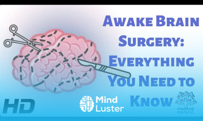Awake Brain Surgery Everything You Need To Know