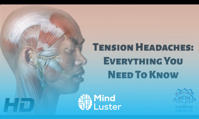 Tension Headaches Everything You Need To Know
