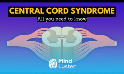 Central Cord Syndrome Is Your Neck Pain Hiding Something More Serious