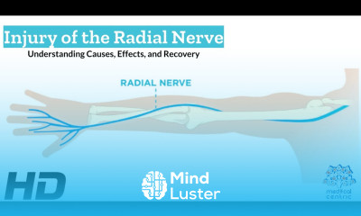 Radial Nerve Injury What You Need to Know