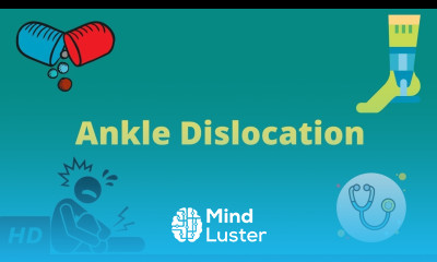 Ankle Dislocation Causes Signs and Symptoms Diagnosis and Treatment