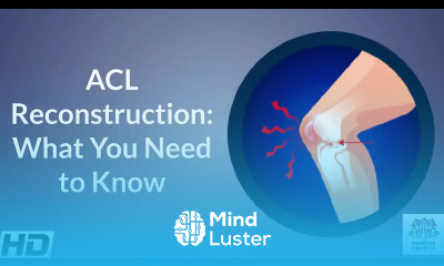 Anterior Cruciate Ligament reconstruction ACL Reconstruction What You Need to Know