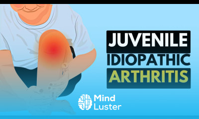 Juvenile Idiopathic Arthritis Everything You Need To Know