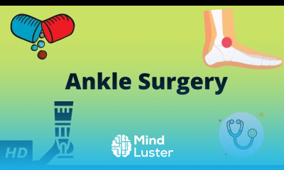 Ankle Surgery Everything You Need to Know