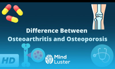 Difference Between Osteoarthritis and Osteoporosis