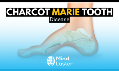 CHARCOT MARIE TOOTH DISEASE CMT