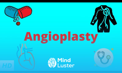 Angioplasty Causes Signs and Symptoms Diagnosis and Treatment