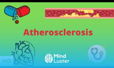 Atherosclerosis Causes Signs and Symptoms Diagnosis and Treatment
