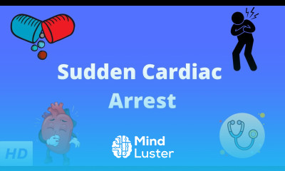 Sudden Cardiac Arrest Causes Signs and Symptoms Diagnosis and Diagnosis