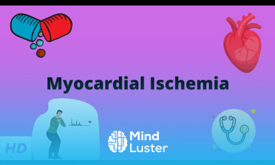 Myocardial Ischemia Causes Signs and Symptoms Diagnosis and Treatment