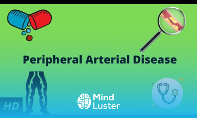 Peripheral Arterial Disease Causes Signs and Symptoms Diagnosis and Treatment