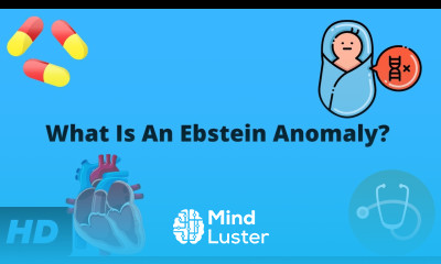 What Is An Ebstein Anomaly Here s Everything You Need To Know