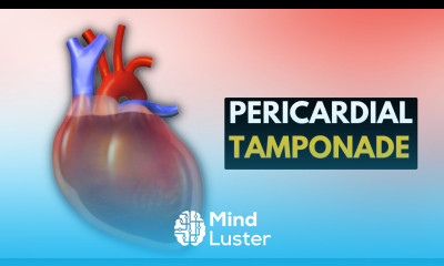 Pericardial Tamponade Everything You Need To Know