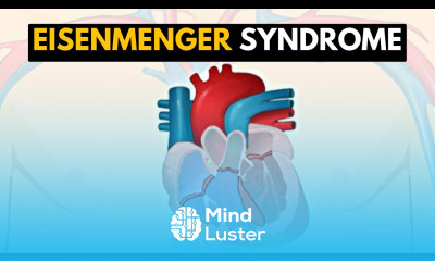 Eisenmenger Syndrome Explained A Comprehensive Guide