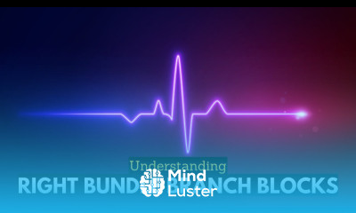 RBBB Uncovered Navigating the Complexities of Right Bundle Branch Blocks