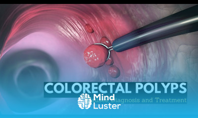Colorectal Polyps Causes Signs and Symptoms Diagnosis and Treatment