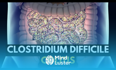 CLOSTRIDIUM DIFFICILE COLITIS Causes Signs and Symptoms Diagnosis and Treatment