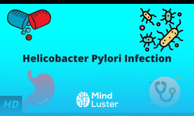 Helicobacter Pylori Infection Causes Signs and Symptoms Diagnosis and Treatment