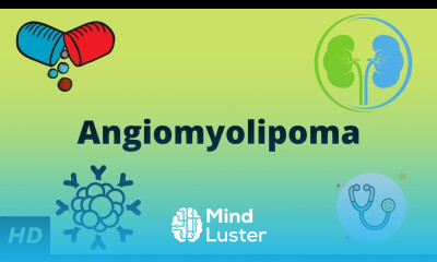 Angiomyolipoma Causes Signs and Symptoms Diagnosis and Treatment