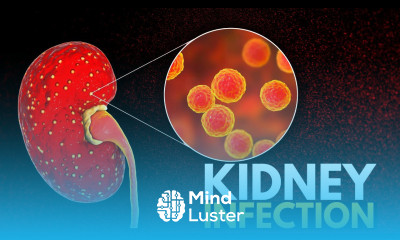 Kidney Infection Causes Signs and Symptoms Diagnosis and Treatment