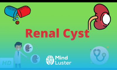 Renal Cyst Causes Signs and Symptoms Diagnosis and Treatment