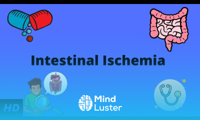 Intestinal Ischemia Causes Signs and Symptoms Diagnosis and Treatment