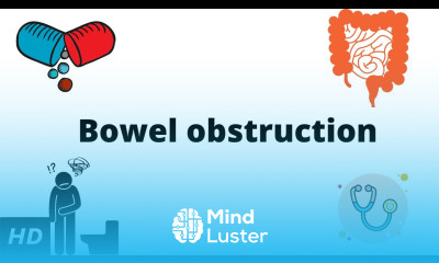 Bowel Obstruction Causes Signs and Symptoms Diagnosis and Treatment