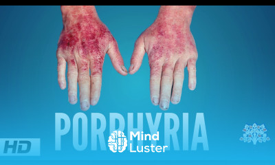 Porphyria Causes Signs and Symptoms Diagnosis and Treatment